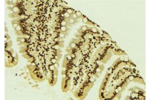 ABIN6266588 at 1/100 staining Mouse colon tissue by IHC-P.