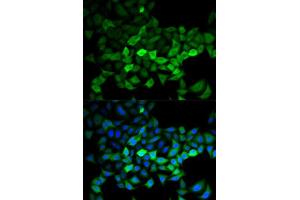 Immunofluorescence analysis of HeLa cells using UBE2C antibody (ABIN5973207). (UBE2C antibody)
