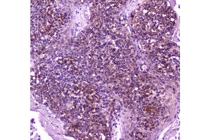 IHC analysis of PLCG 2 using anti-PLCG 2 antibody . (Phospholipase C gamma 2 antibody  (AA 1201-1258))
