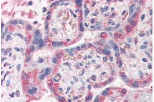 Human Placenta (formalin-fixed, paraffin-embedded) stained with PDLIM1 antibody ABIN337145 at 5 ug/ml followed by biotinylated anti-goat IgG secondary antibody ABIN481715, alkaline phosphatase-streptavidin and chromogen. (PDLIM1 antibody  (AA 316-329))
