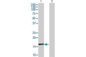 Western Blot analysis of RARRES3 expression in transfected 293T cell line by RARRES3 MaxPab polyclonal antibody.