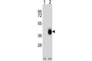 Western blot analysis of FCAR (arrow) using rabbit polyclonal FCAR Antibody (Center) . (FCAR antibody  (Middle Region))