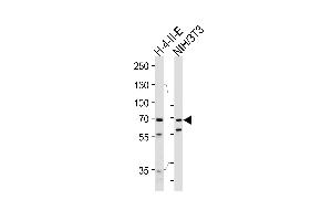 Western blot analysis of lysates from rat H-4-II-E, mouse NIH/3T3 cell line (from left to right), using HS Antibody (C-term) (ABIN1944844 and ABIN2839489).