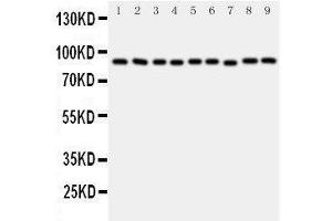 Western Blotting (WB) image for anti-Valosin Containing Protein (VCP) (AA 749-766), (C-Term) antibody (ABIN3043984) (VCP antibody  (C-Term))