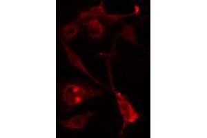 ABIN6274590 staining Hela cells by IF/ICC. (RALGAPA2 antibody  (Internal Region))