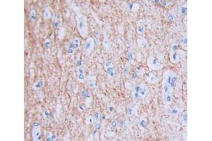 Used in DAB staining on fromalin fixed paraffin- embedded Kidney tissue (PUS1 antibody  (AA 1-427))