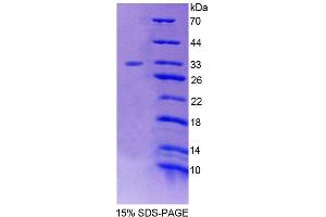 SDS-PAGE analysis of Human FOXO3 Protein. (FOXO3 Protein)