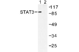 Image no. 1 for anti-Signal Transducer and Activator of Transcription 3 (Acute-Phase Response Factor) (STAT3) antibody (ABIN271827) (STAT3 antibody)