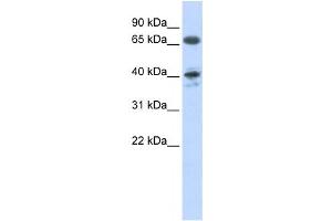 Western Blotting (WB) image for anti-Angiotensin II Receptor, Type 1 (AGTR1) antibody (ABIN2458631)