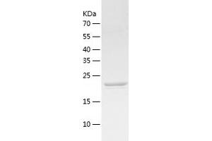 Western Blotting (WB) image for Adenylate Kinase 2 (AK2) (AA 1-239) protein (His tag) (ABIN7286484) (Adenylate Kinase 2 Protein (AK2) (AA 1-239) (His tag))