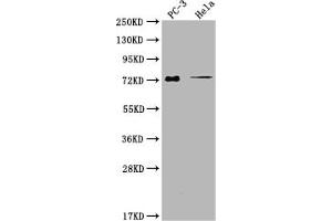Western Blot Positive WB detected in: PC-3 whole cell lysate, Hela whole cell lysate All lanes: GLB1L3 antibody at 1:2000 Secondary Goat polyclonal to rabbit IgG at 1/50000 dilution Predicted band size: 75, 36 kDa Observed band size: 75 kDa (GLB1L3 antibody  (AA 1-236))