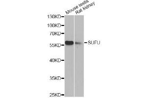 Western blot analysis of extracts of various cell lines, using SUFU antibody (ABIN6293839) at 1:1000 dilution. (SUFUH antibody)