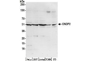Western Blotting (WB) image for anti-CNDP Dipeptidase 2 (Metallopeptidase M20 Family) (CNDP2) (AA 100-150) antibody (ABIN7449700)
