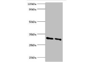 Western blot All lanes: KCTD15 antibody at 8 μg/mL Lane 1: 293T whole cell lysate Lane 2: Hela whole cell lysate Secondary Goat polyclonal to rabbit IgG at 1/10000 dilution Predicted band size: 32, 27 kDa Observed band size: 32 kDa (KCTD15 antibody  (AA 1-234))
