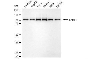 anti-Squamous Cell Carcinoma Antigen Recognized By T Cells (SART1) antibody