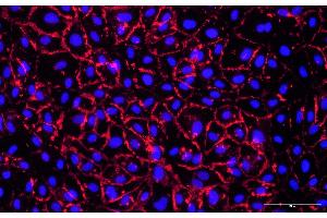 HUVEC cells were stained using a primary rabbit anti-human CD31 antibody, followed by detection with animal-free AlexaFluor555-conjugated anti-rabbit IgG secondary Multiclonal antibody (ABIN7581785). (Recombinant Mouse anti-Rabbit IgG Antibody (Alexa Fluor 555))