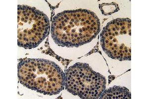 Used in DAB staining on fromalin fixed paraffin- embedded testis tissue (KRT15 antibody  (AA 94-402))