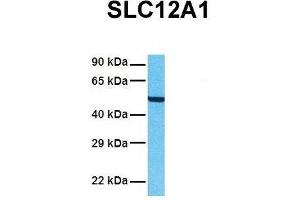 Host:  Rabbit  Target Name:  SLC12A1  Sample Tissue:  Human A549  Antibody Dilution:  1. (SLC12A1 antibody  (N-Term))