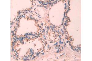 Used in DAB staining on fromalin fixed paraffin- embedded Kidney tissue (TCN2 antibody  (AA 19-427))