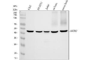 Western blot analysis of SSTR2 using anti-SSTR2 antibody (ABIN7606349).