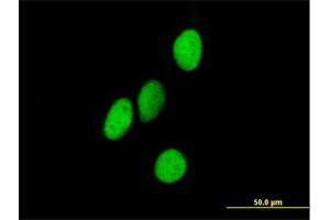 Immunofluorescence of purified MaxPab antibody to ORC4L on HeLa cell. (ORC4 antibody  (AA 1-436))