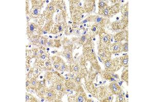 Immunohistochemistry of paraffin-embedded Human liver injury using KIF3A antibody at dilution of 1:100 (x400 lens). (KIF3A antibody)