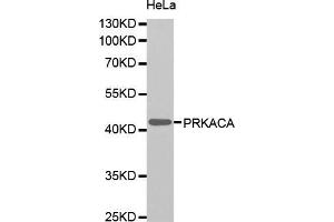 Western blot analysis of extracts of HeLa cells, using PRKACA antibody (ABIN5995919). (PRKACA antibody)