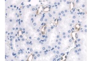 #VALUE! (PTH2R antibody  (AA 27-143))
