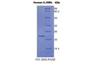 SDS-PAGE (SDS) image for Interleukin 10 Receptor, beta (IL10RB) (AA 87-243) protein (His tag) (ABIN1980971) (IL10RB Protein (AA 87-243) (His tag))