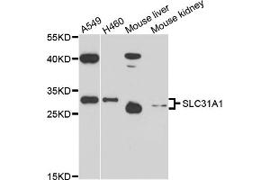 Western blot analysis of extracts of various cell lines, using SLC31A1 antibody (ABIN6003807) at 1/1000 dilution. (SLC31A1 antibody)