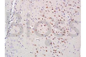 Formalin-fixed and paraffin embedded mouse brain labeled with Anti-A2AR/Adenosine A2a Polyclonal Antibody, Unconjugated (ABIN686797) at 1:200 followed by conjugation to the secondary antibody and DAB staining (Adenosine A2a Receptor antibody  (AA 165-300))