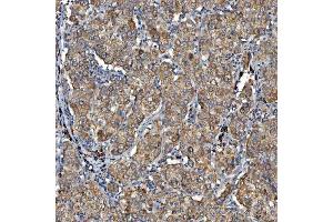 IHC analysis of SDF2L1 using anti-SDF2L1 antibody (ABIN7601111).