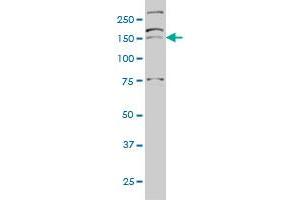 AATK monoclonal antibody (M03), clone 5B8 Western Blot analysis of AATK expression in Hela S3 NE . (AATK antibody  (AA 161-260))