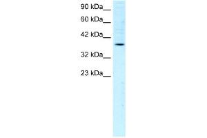 WB Suggested Anti-FOSB Antibody Titration:  1. (FOSB antibody  (C-Term))