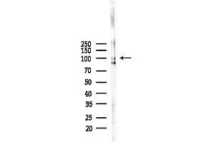 anti-Integrin beta 5 (ITGB5) (C-Term) antibody