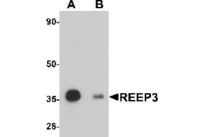 Western Blotting (WB) image for anti-Receptor Accessory Protein 3 (REEP3) (C-Term) antibody (ABIN1030616) (REEP3 antibody  (C-Term))