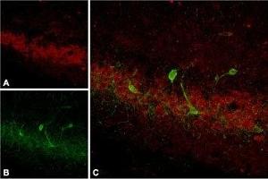 Expression of SSTR4 in rat hippocampus - Immunohistochemical staining of rat hippocampus using Anti-Somatostatin Receptor Type 4 (extracellular) Antibody, (ABIN7043766, ABIN7045265 and ABIN7045266). (SSTR4 antibody  (2nd Extracellular Loop))