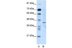 WB Suggested Anti-RING1  Antibody Titration: 5. (RING1 antibody  (N-Term))