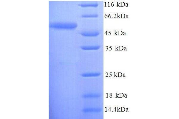 D-Serine Dehydratase Protein (DSDA) (AA 1-440, full length) (His tag)