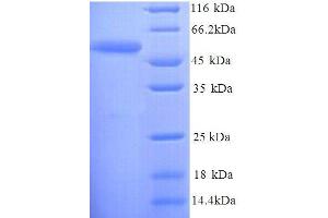 Serine Racemase (SRR) (AA 1-440), (full length) protein (His tag)