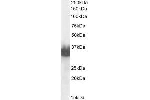 ABIN6391379 (0. (Prostate Specific Antigen antibody  (C-Term))