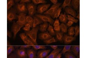 Immunofluorescence analysis of U-2 OS cells using NEXN Polyclonal Antibody at dilution of 1:100. (NEXN antibody)