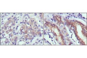 Immunohistochemical analysis of paraffin-embedded human gastric cancer (left) and normal gastric tissues (right) using CER1 mouse mAb with DAB staining. (CER1 antibody)