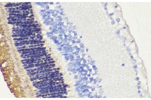 Immunohistochemistry of paraffin-embedded Mouse retina using RHO Polyclonal Antibody at dilution of 1:200 (40x lens).