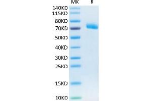 Human IL-12 R beta 1 on Tris-Bis PAGE under reduced condition. (IL12RB1 Protein (AA 24-540) (His tag))