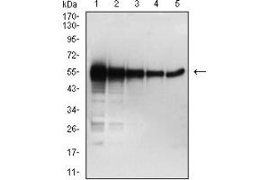 Western blot analysis using SARS-CoV-2-NP2 mAb against human SARS-CoV-2-N (AA: 1-419) recombinant protein. (SARS-Cov2-NP2 (AA 120-300) antibody)
