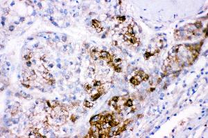 Immunohistochemistry (Paraffin-embedded Sections) (IHC (p)) image for anti-Cystathionine-beta-Synthase (CBS) (AA 331-551) antibody (ABIN3043747)