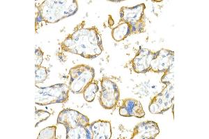 Immunohistochemistry (IHC) image for anti-CD38 (AA 1-300) antibody (ABIN1679089)