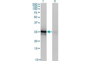 Western Blot analysis of FGF21 expression in transfected 293T cell line by FGF21 monoclonal antibody (M03), clone 3G10.