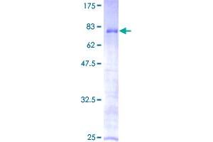 Image no. 1 for Zinc Finger Protein 70 (ZNF70) protein (GST tag) (ABIN1326395)